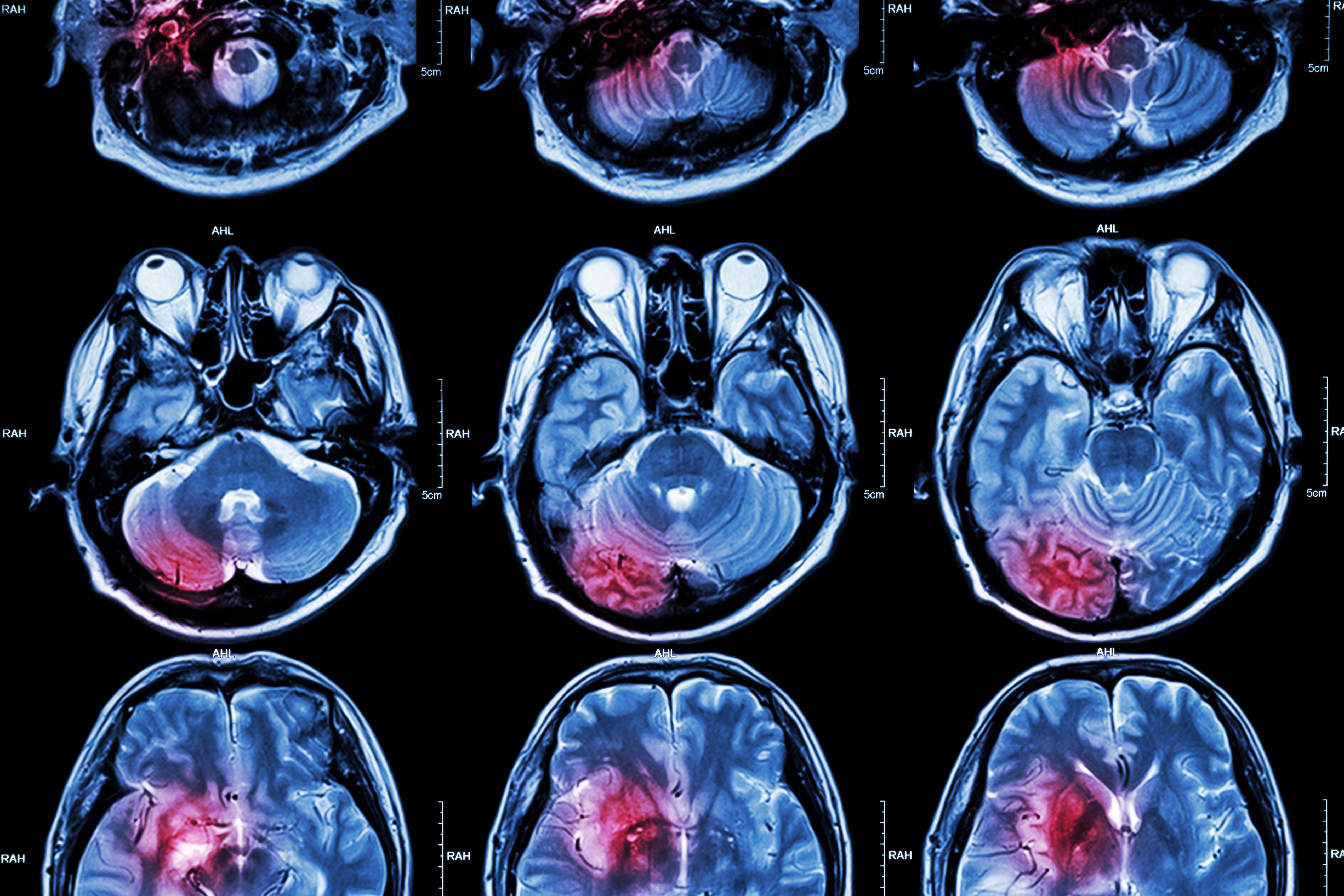 Brain Scan